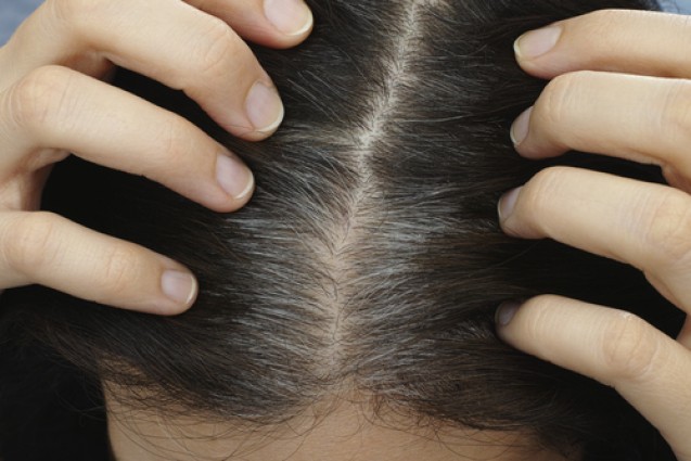 Rambut yang beruban